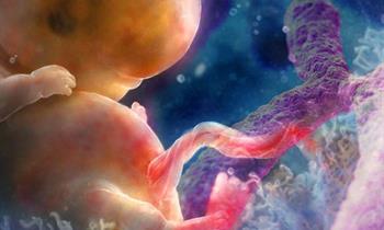 نتايج استفاده از تست‌هاي غيرتهاجمي دوران بارداري جهت تشخيص سندرم داون با استفاده از DNA آزاد جنيني در سرويس سلامت ملي اسپانيا: تجزيه و تحليل مقرون به صرفه بودن هزينه‌ها